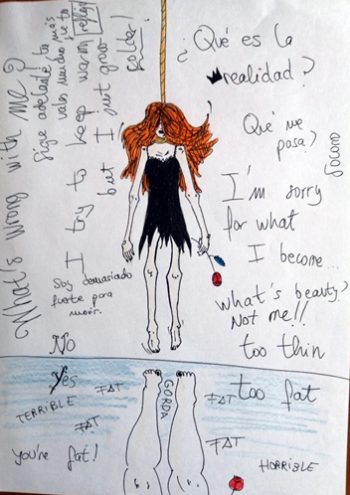 7-Anorexia