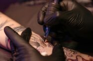retirada de tintas de tatuaje