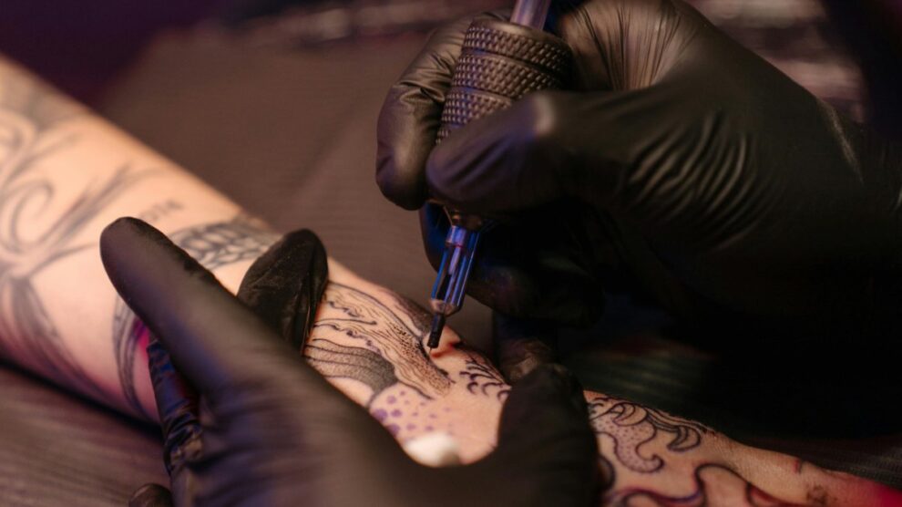 retirada de tintas de tatuaje