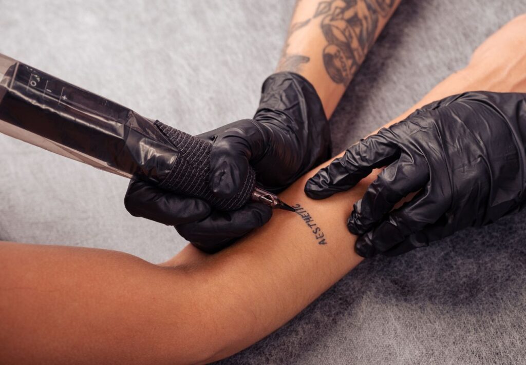 retirada de tintas de tatuaje